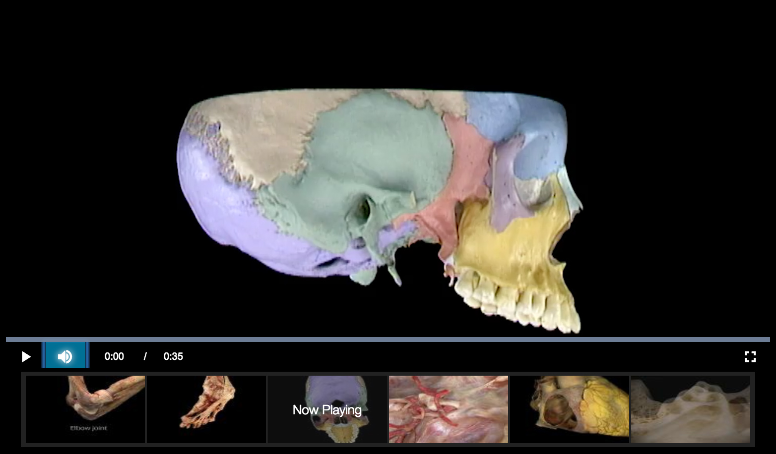 Sphenoid bone